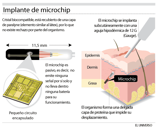 La marca de la bestia de Apocalipsis 13 y 14, posiblemente sea un chip veterinario. https://uncatolicoperplejo.com/la-marca-de-la-bestia-de-apocalipsis/