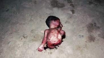 Planned Parenthood. Aborto. Bebé descuartizado.